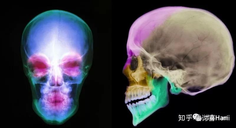 如何判断一个人的颧骨是高还是低？ - 知乎