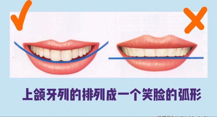 微笑新标准，笑线要好看，如何用正畸逆袭 - 知乎