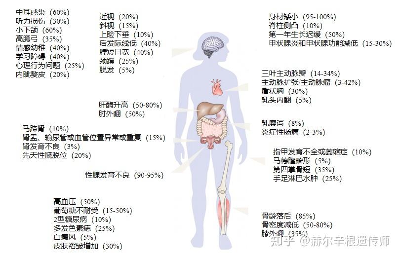 性腺发育不良图片