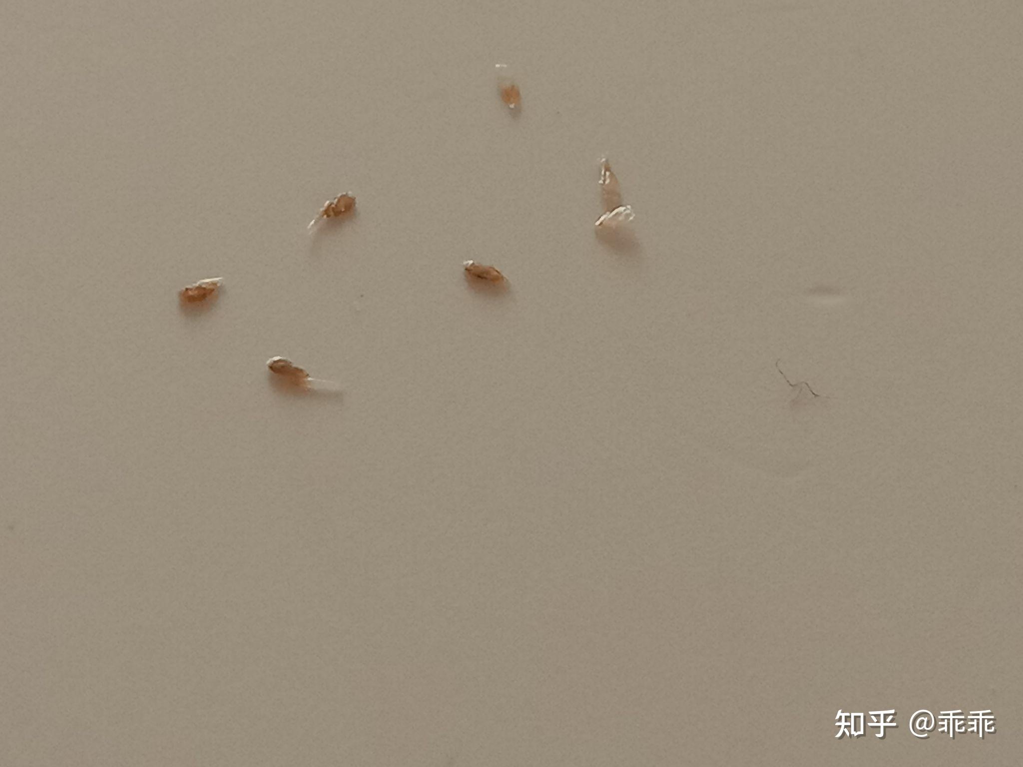油脂粒和虱子卵的图片图片
