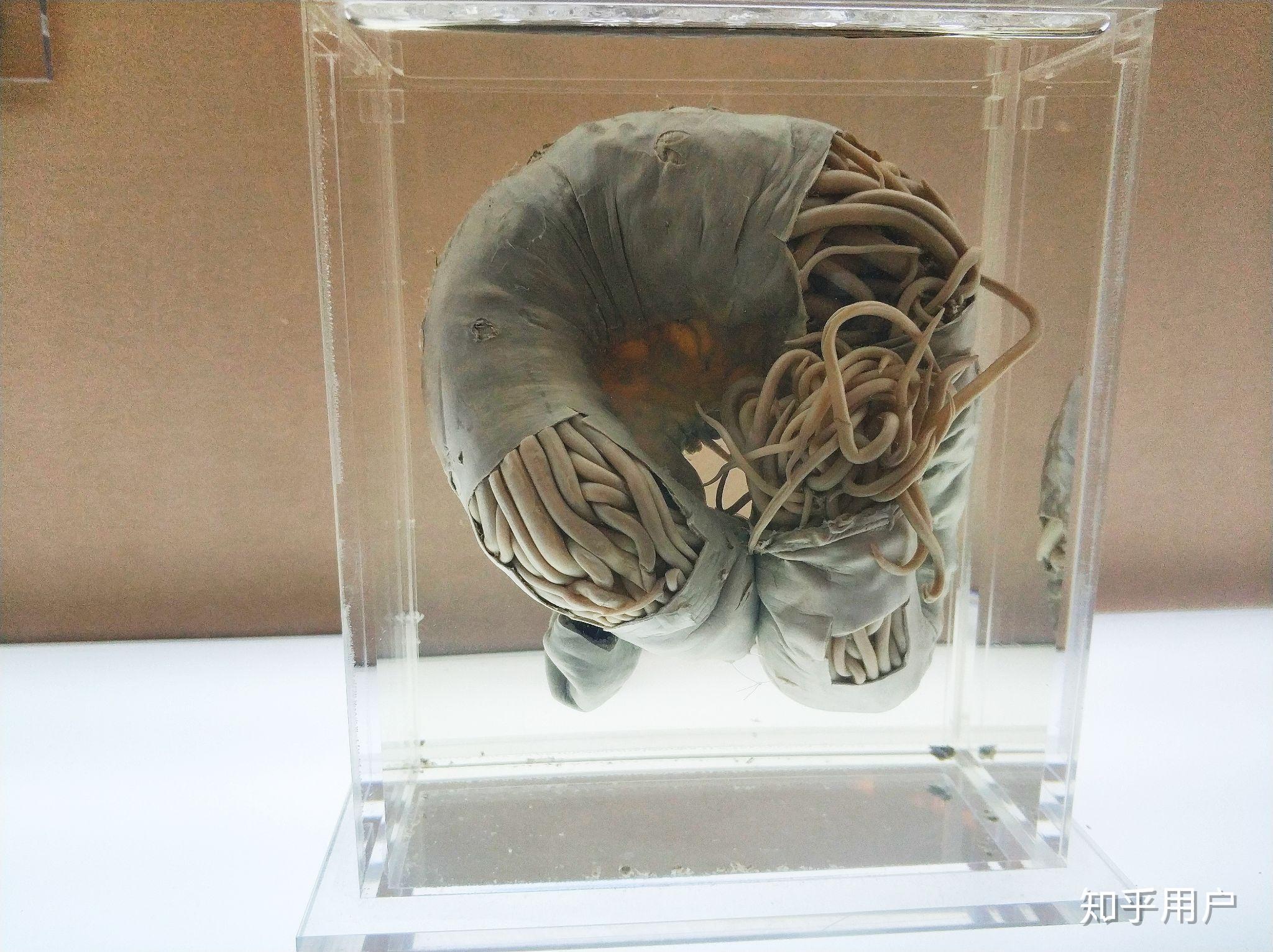 蛔虫对人体影响有多大