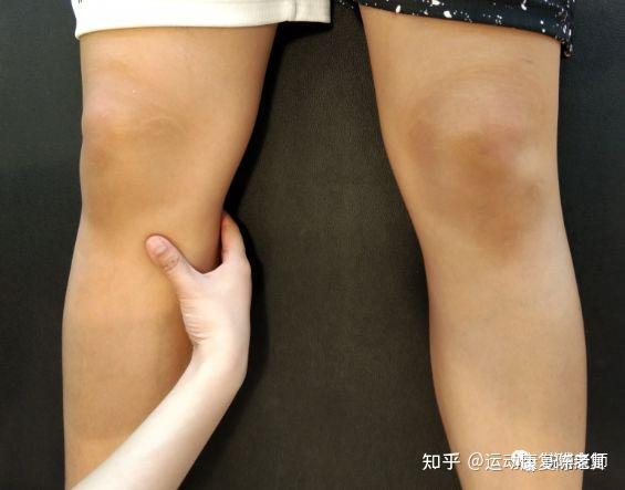 跑完步膝盖内侧痛怎么办? - 知乎