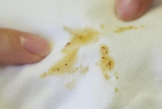 衣服上的油渍放久了怎么洗干净? - 知乎