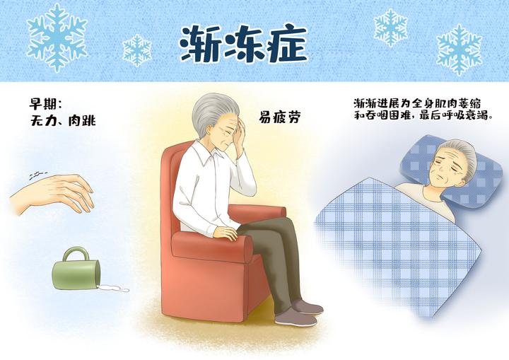 6.21世界渐冻人日丨带你了解世界五大绝症之首——渐冻症 - 知乎