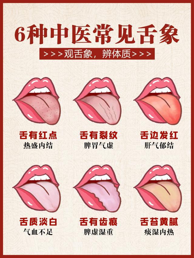4种常见的“脾虚”舌象!5秒自查→ - 知乎