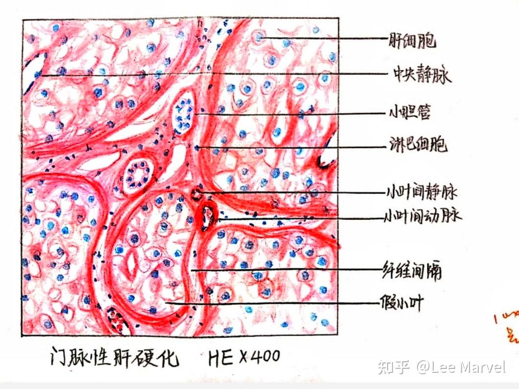 為什麼咱們不弄個病理紅藍手繪圖的問題呢