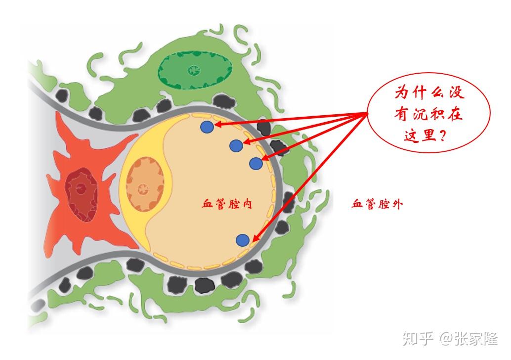 膜性肾病怎么引起的?