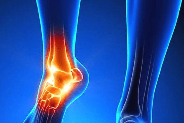 有时候踝关节出现弹响,可能有这些问题