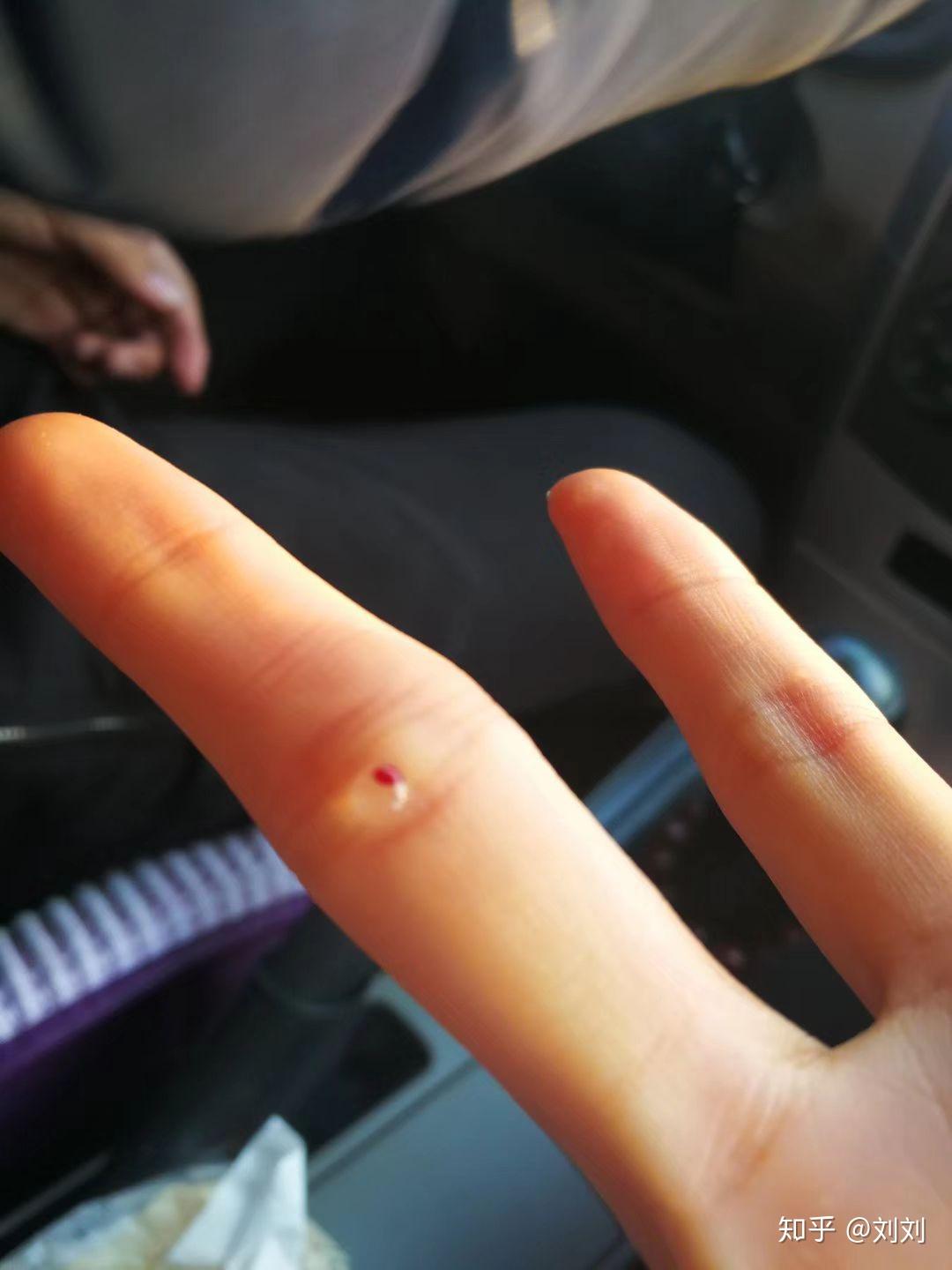 攻心翻到底是一种什么病