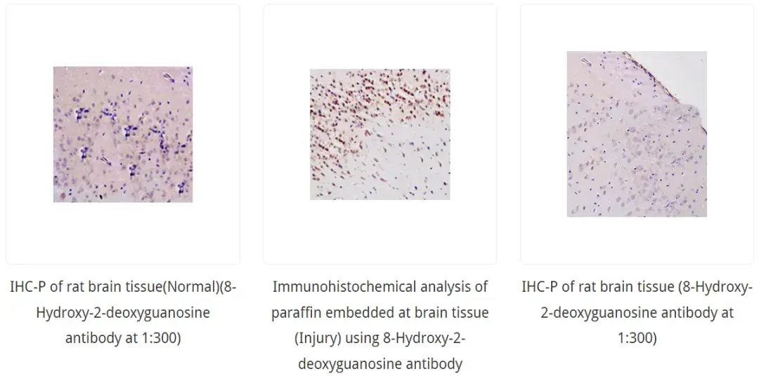 【Biorbyt科研专题】“氧化应激”生物标志物 知乎