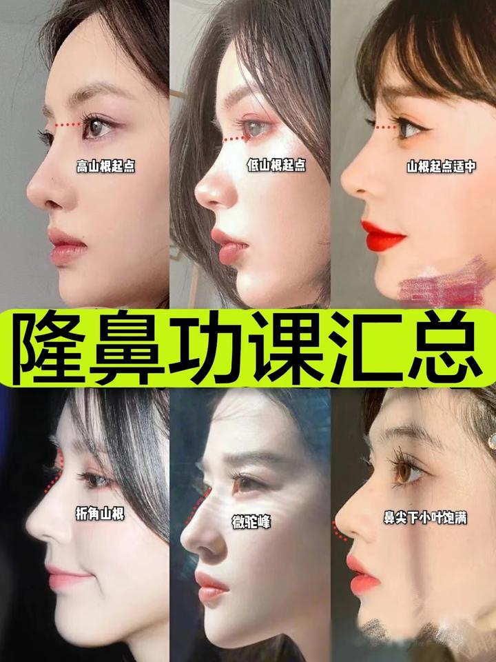 隆鼻手术怎么选择适合自己的鼻型?直鼻、翘鼻、直鼻微翘、水滴鼻哪种更好看?硅胶膨体怎么选?隆鼻审美功课大总结!(推荐收藏) - 知乎