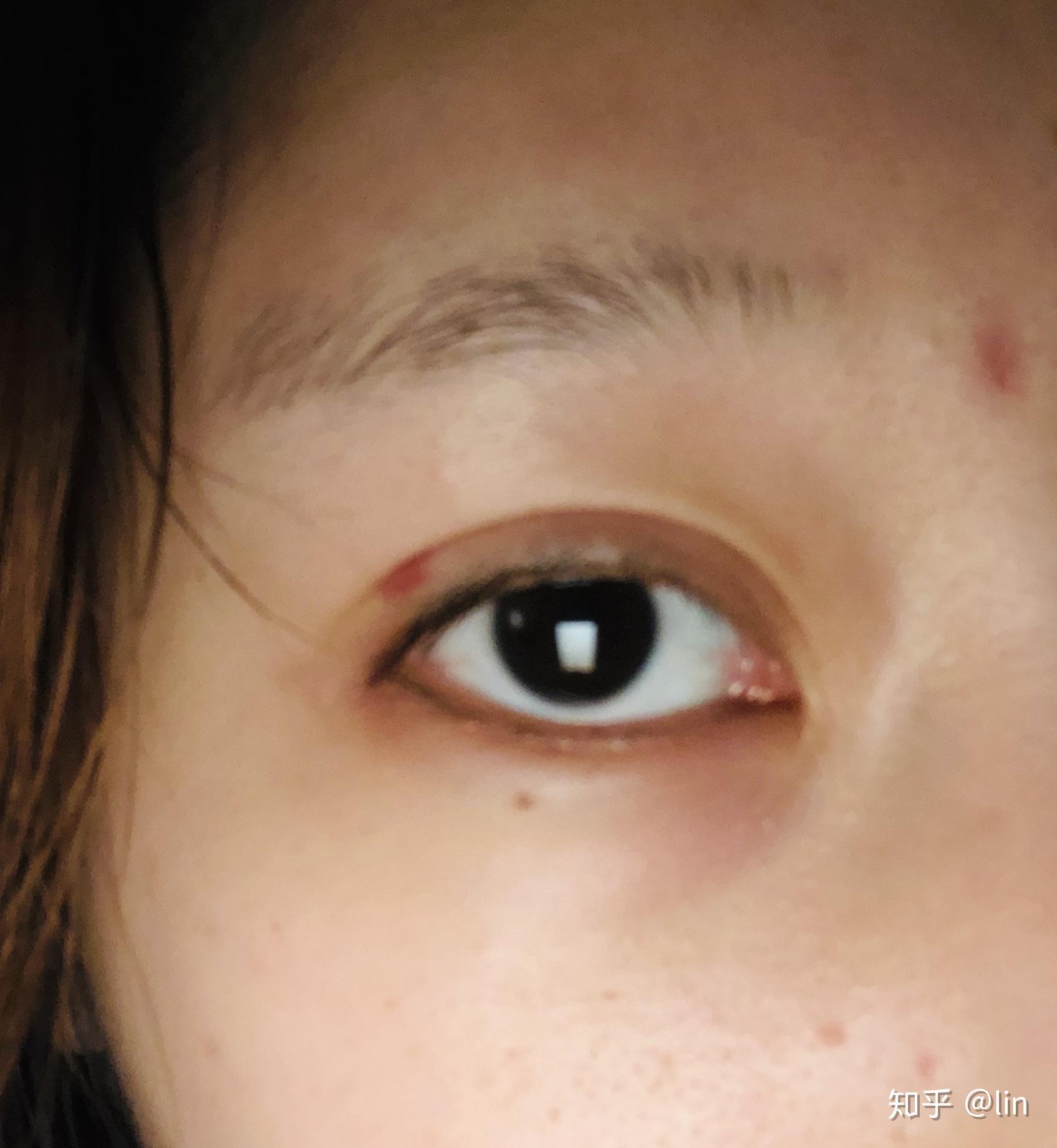 为什么有人说妖痣可怕妖痣究竟长在哪里