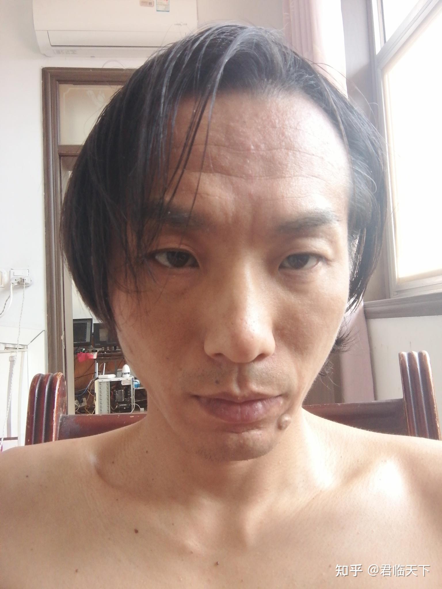 男生长得丑还留长发是什么体验?