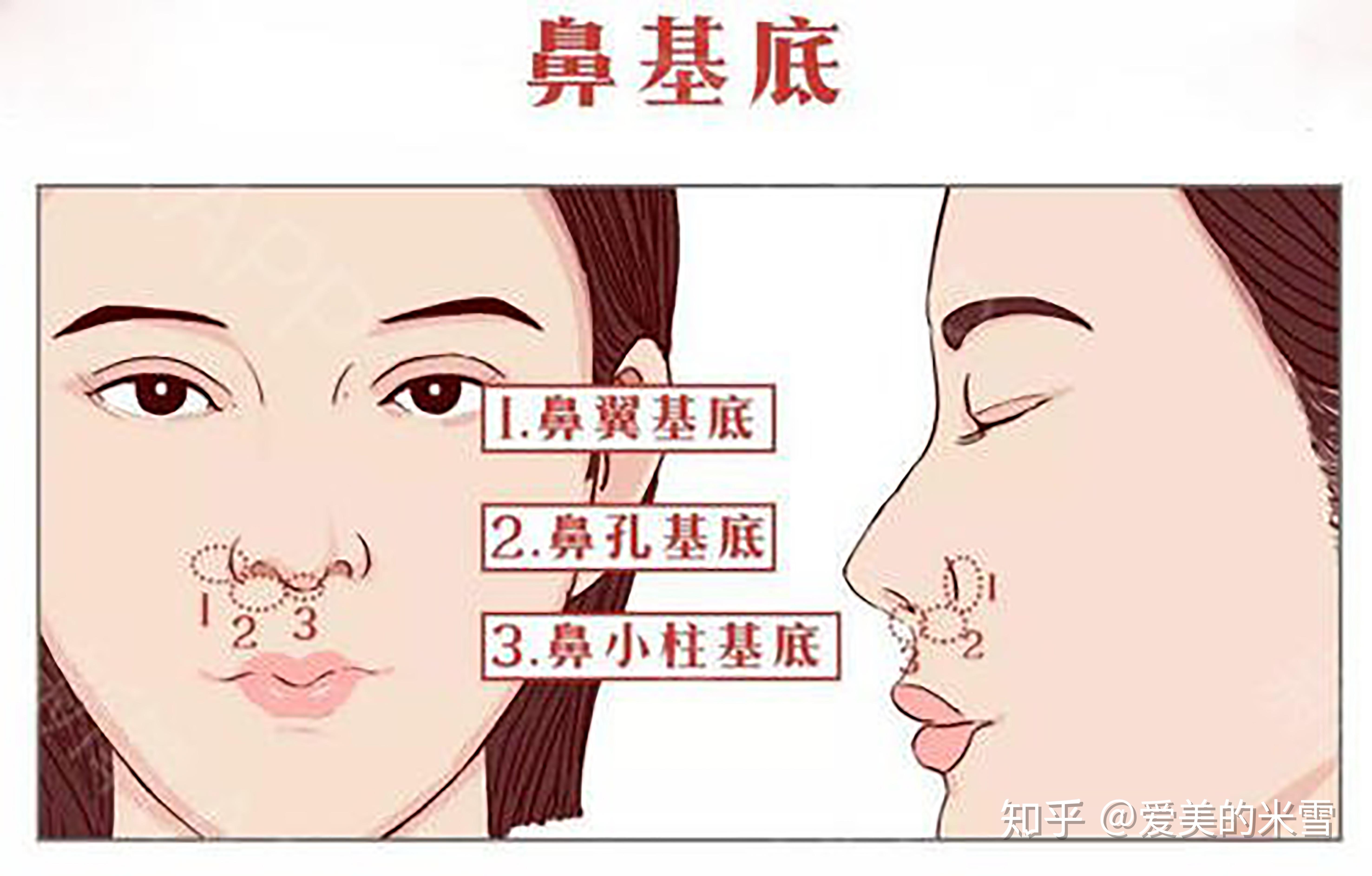 鼻樑與鼻頭都很扁塌的鼻子應該如何改善？ - 上海九院韋敏技術團隊_FANSWONG