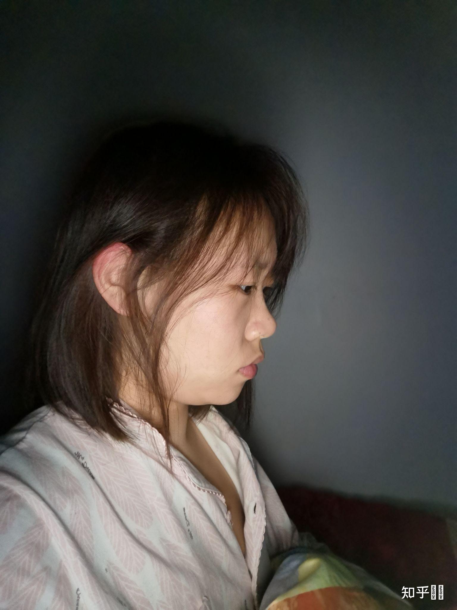 没有鼻梁鼻子塌的人是什么体验