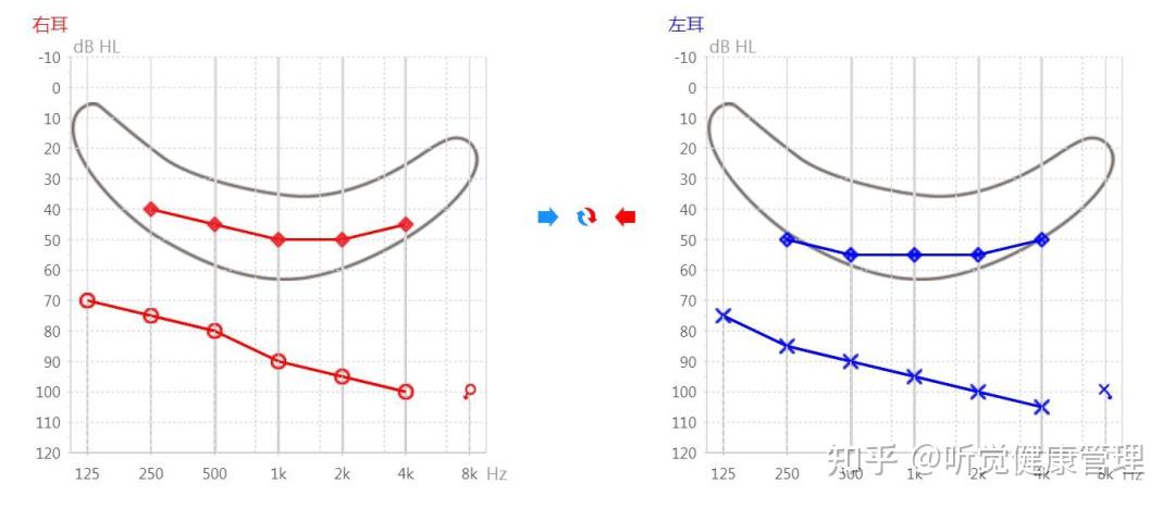 什么是听力的言语香蕉图?