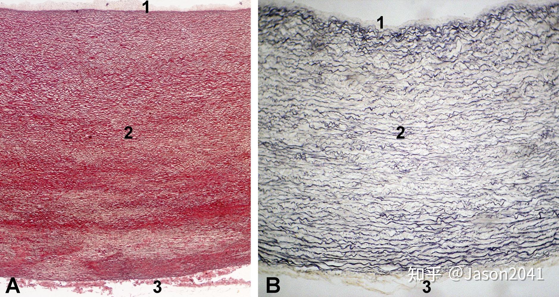 动脉或静脉壁通常可分为哪几层结构