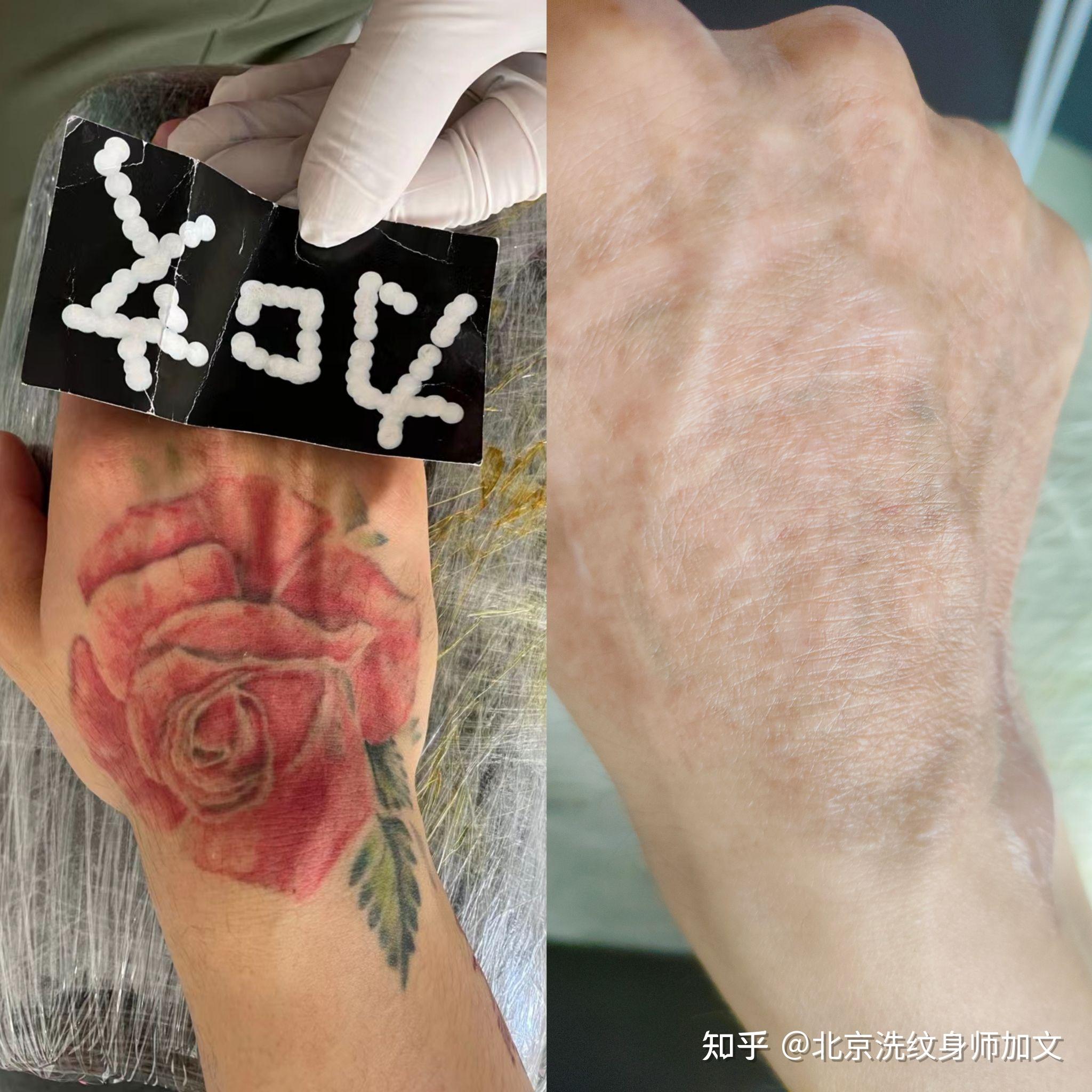 礼貌问一下各位纹身师这样的红色纹身可以清洗干净吗? - 知乎