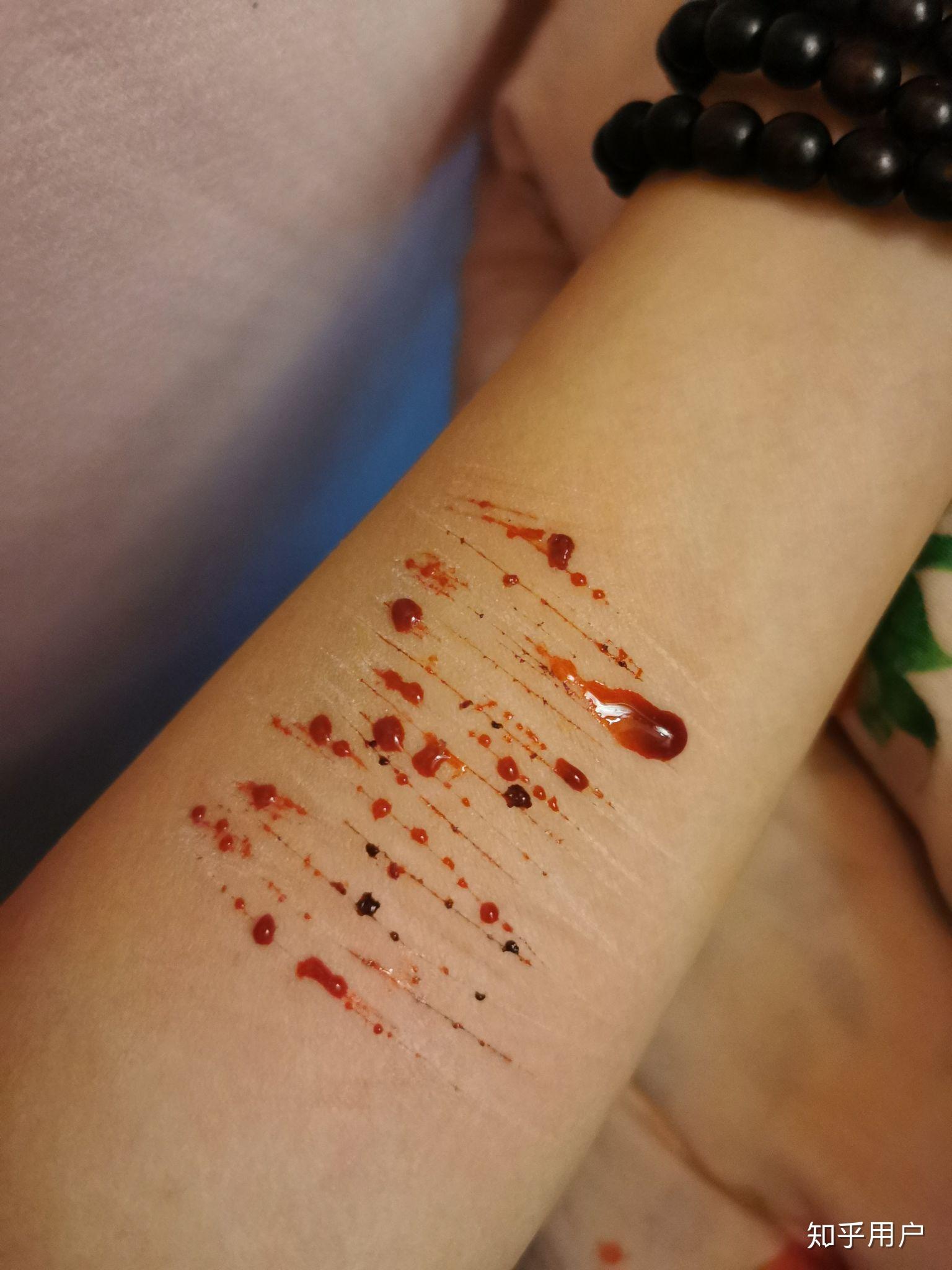 自残属于什么心理