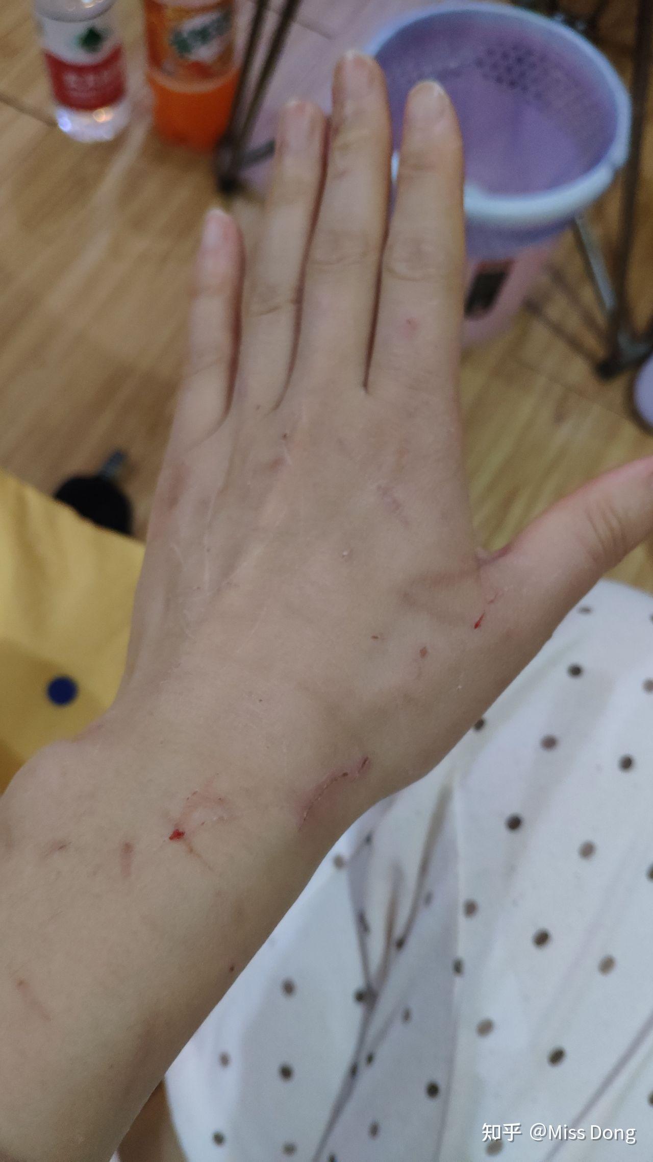 养猫的人经常会被猫抓伤吗? - 知乎