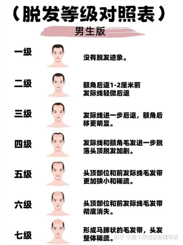 为什么秋季掉头发特别厉害怎么办百科在线 为什么秋季掉头发特别厉害怎么办百科在线