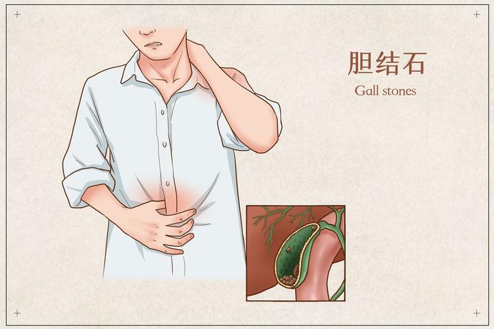 吃完饭感觉胃部不舒服，总以为是胃病，有可能是…… - 知乎