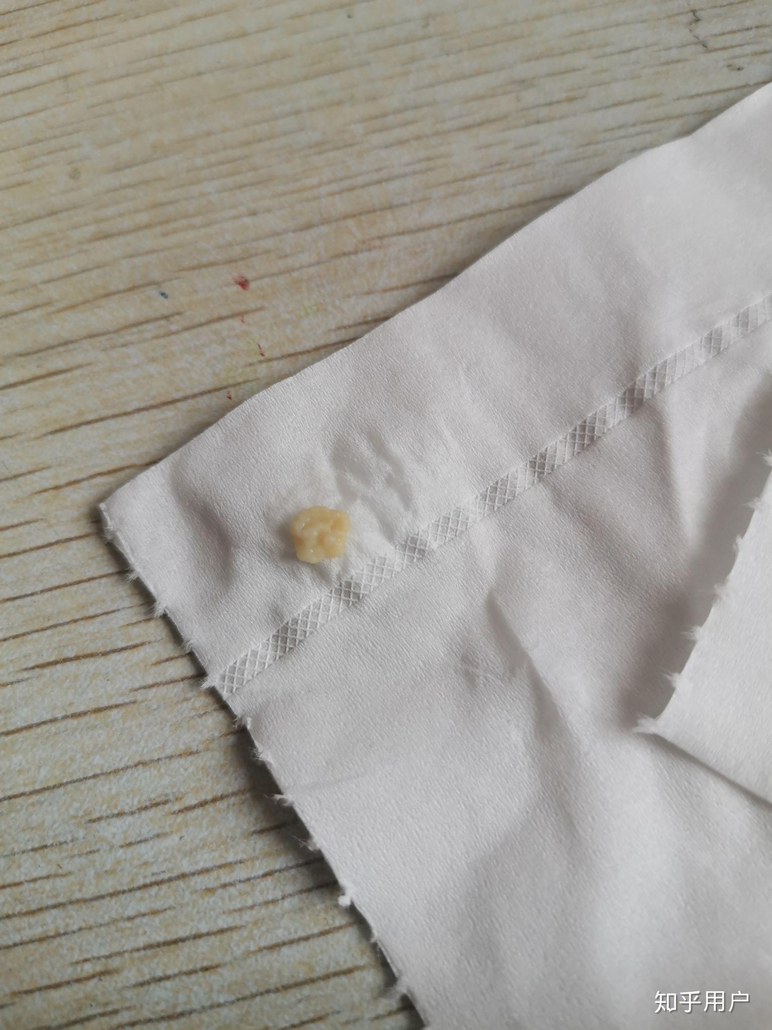 看知乎上那么多人都能自己清理扁桃体结石就我不能为什么