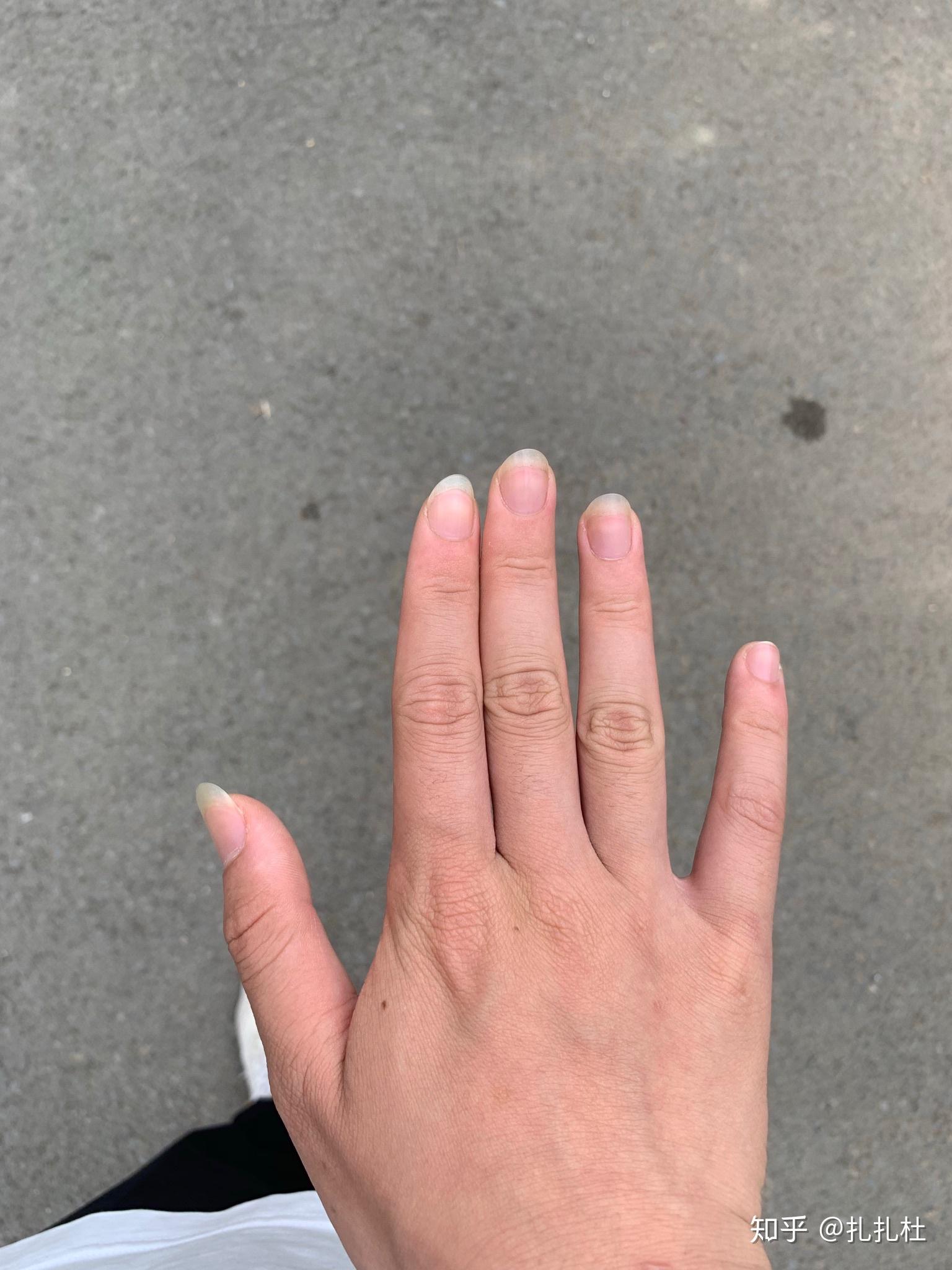 弹古典吉他要怎么留指甲本人女