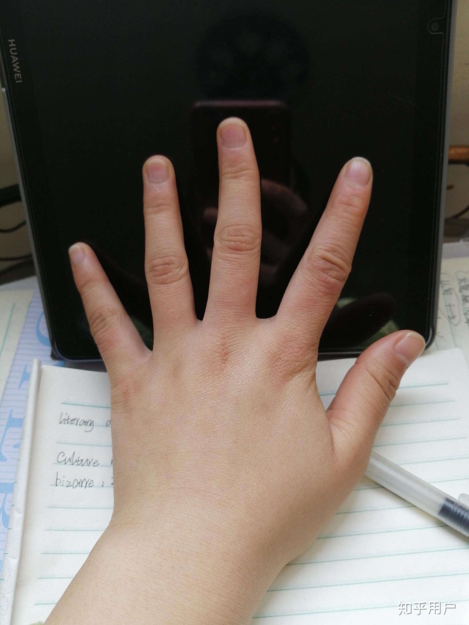 女生的手丑成这样怎么办? - 知乎