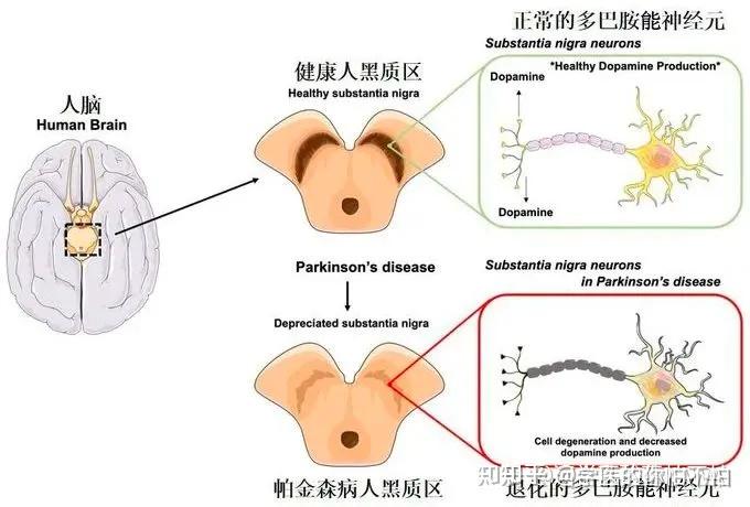 黑质纹状体通路图片