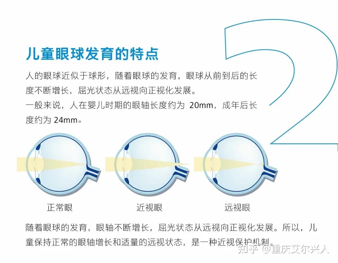 眼轴发育受什么影响