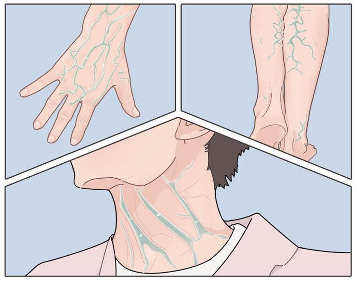 下体这个部位青筋暴起是有男人味还是大病前兆