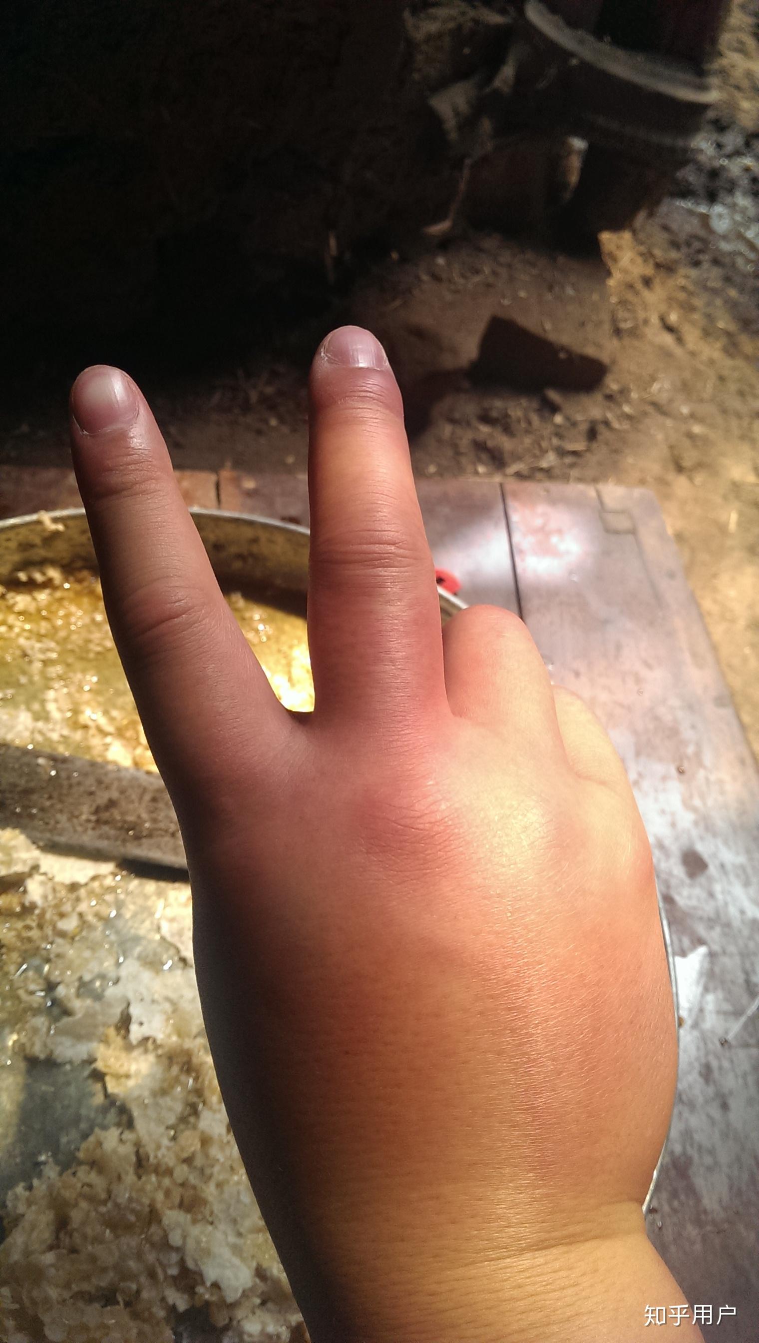 能忍受蜜蜂的蛰刺算是勇敢的豪侠吗