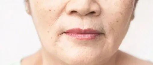 很遗憾，人真的会在34岁突然变老变丑，会断崖式衰老 - 知乎