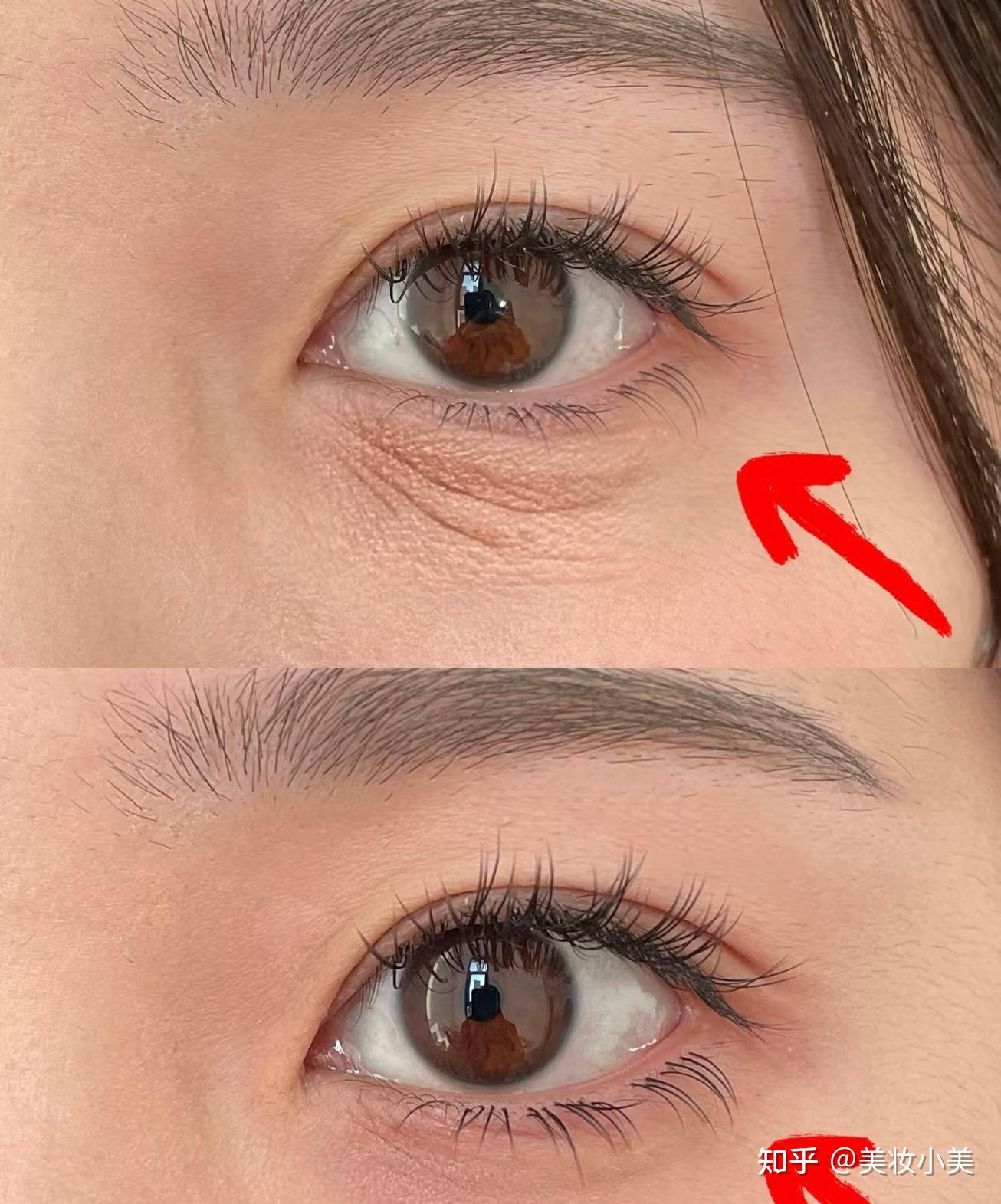 眼下有眼纹的姐妹赶紧看!