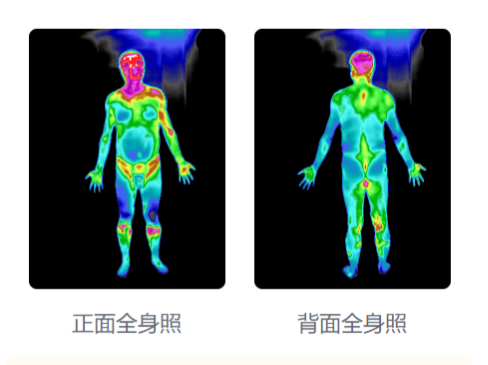红外检测如何判断【气虚体质】 - 知乎
