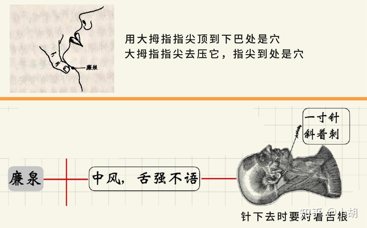 海厦针灸课笔记(5)— 任脉之鸠尾、膻中、天突 - 知乎