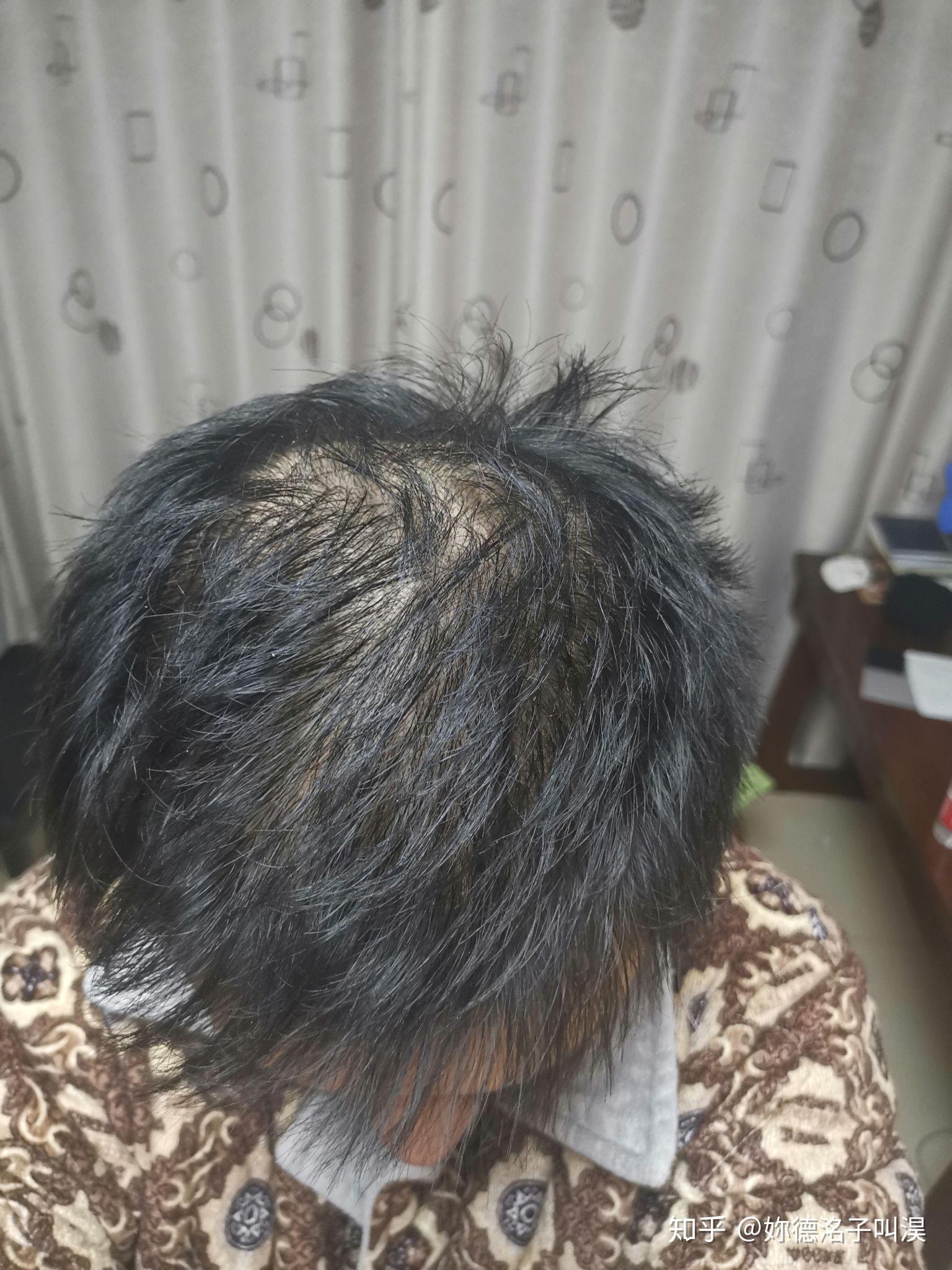 男生头发少稀疏细软适合留什么发型