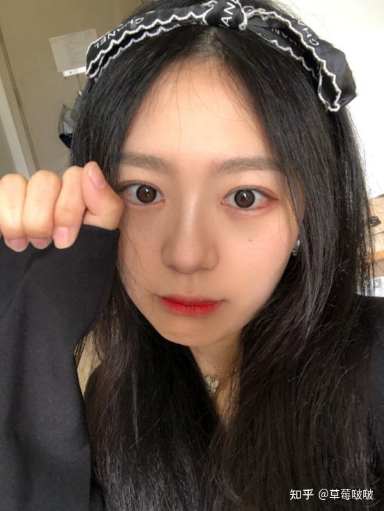 脸上长斑怎么办?-脸部长斑怎么内调