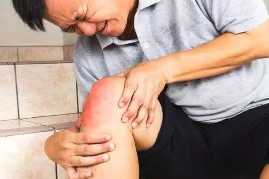 为什么痛风人群越来越多，并出现年轻化趋势？