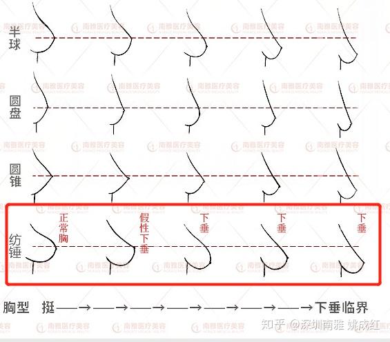 为什么网络上的大胸妹不下垂我老婆才80d就下垂纺锤胸
