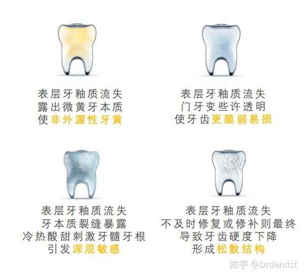 牙齿的矿化和脱矿是什么意思?