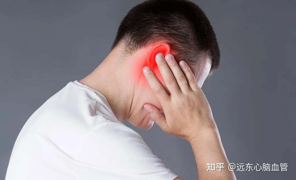 面部剧烈疼痛：真的是“顽固性牙痛”吗？ 知乎 