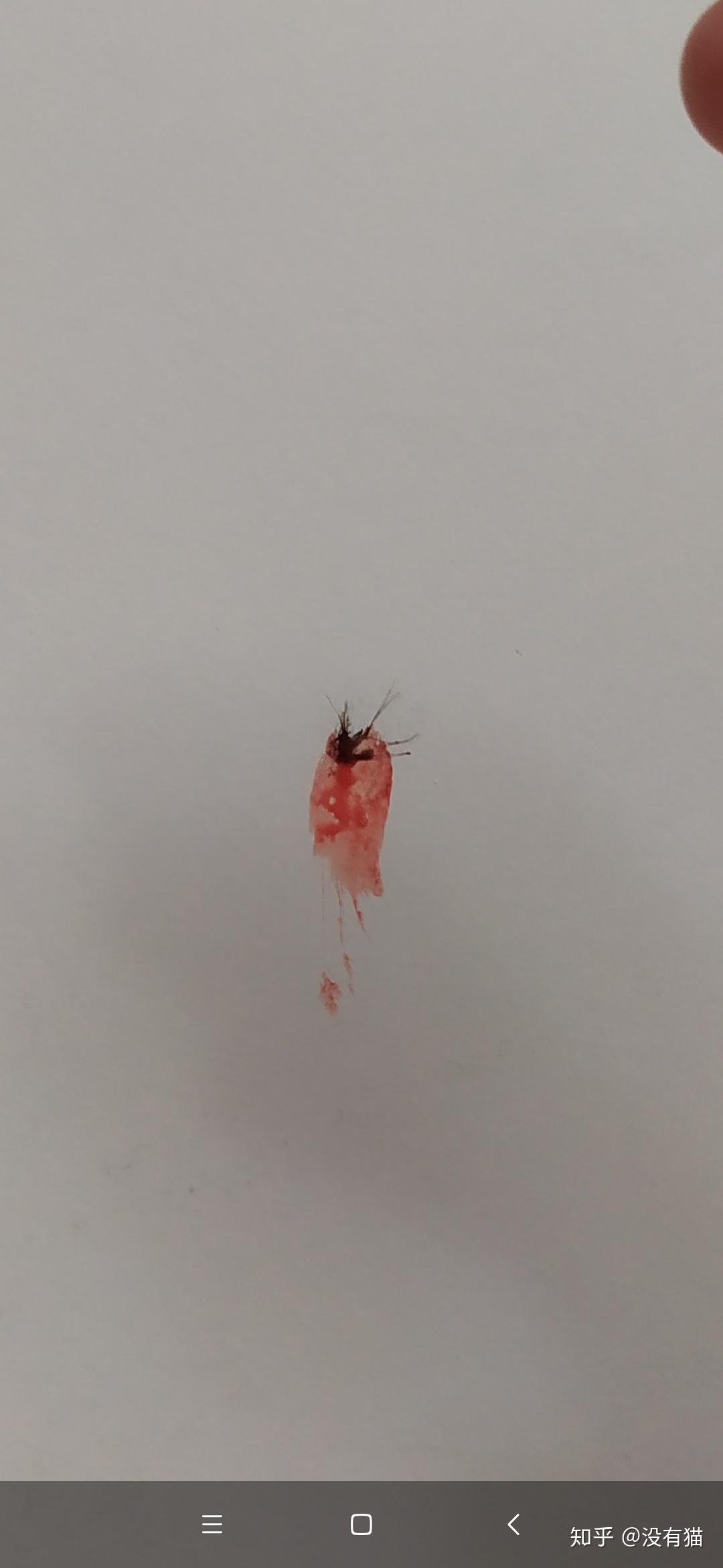 在墙上拍死蚊子后墙上的血迹有没有什么好的处理方法