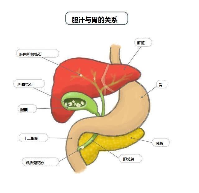 胆汁不是该进胃吗