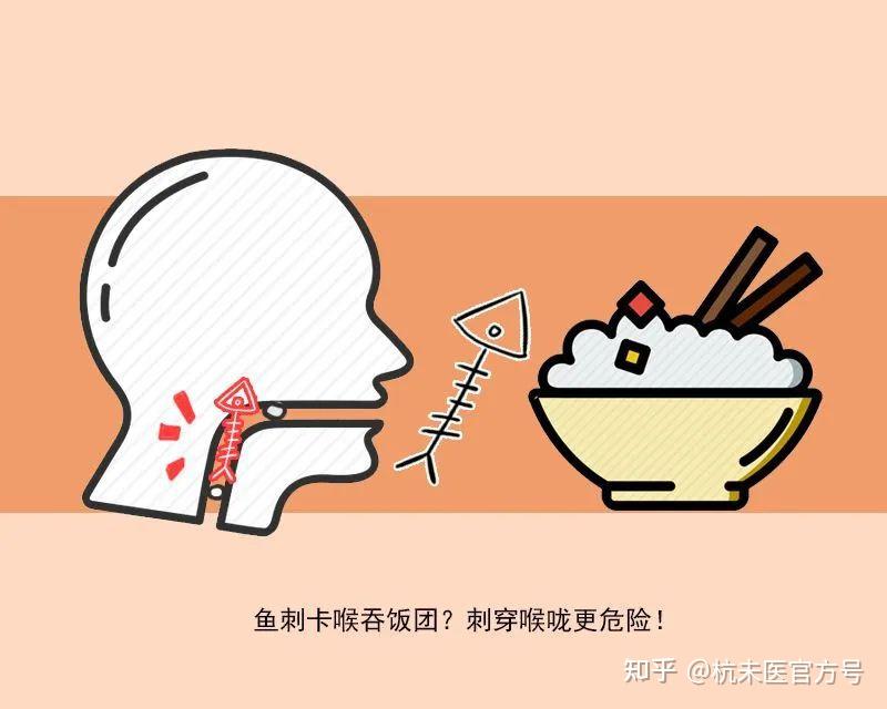 为了一根小鱼刺,跑了三家医院! - 知乎