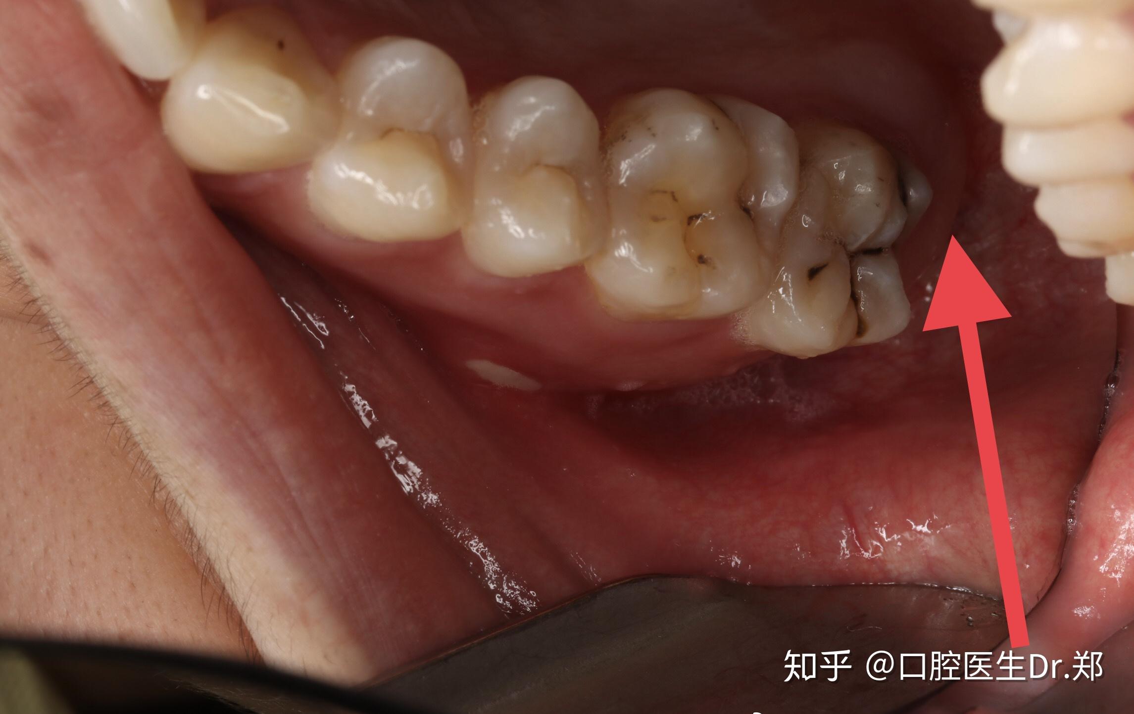 健康牙齿全景片的图片,正常牙齿健康牙齿图片,健康的牙齿和蛀牙图片(第2页)_大山谷图库