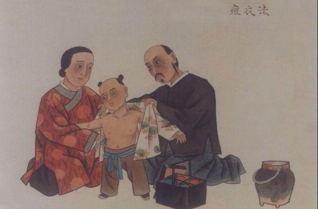 「天花」是一种怎样的传染病? - 知乎