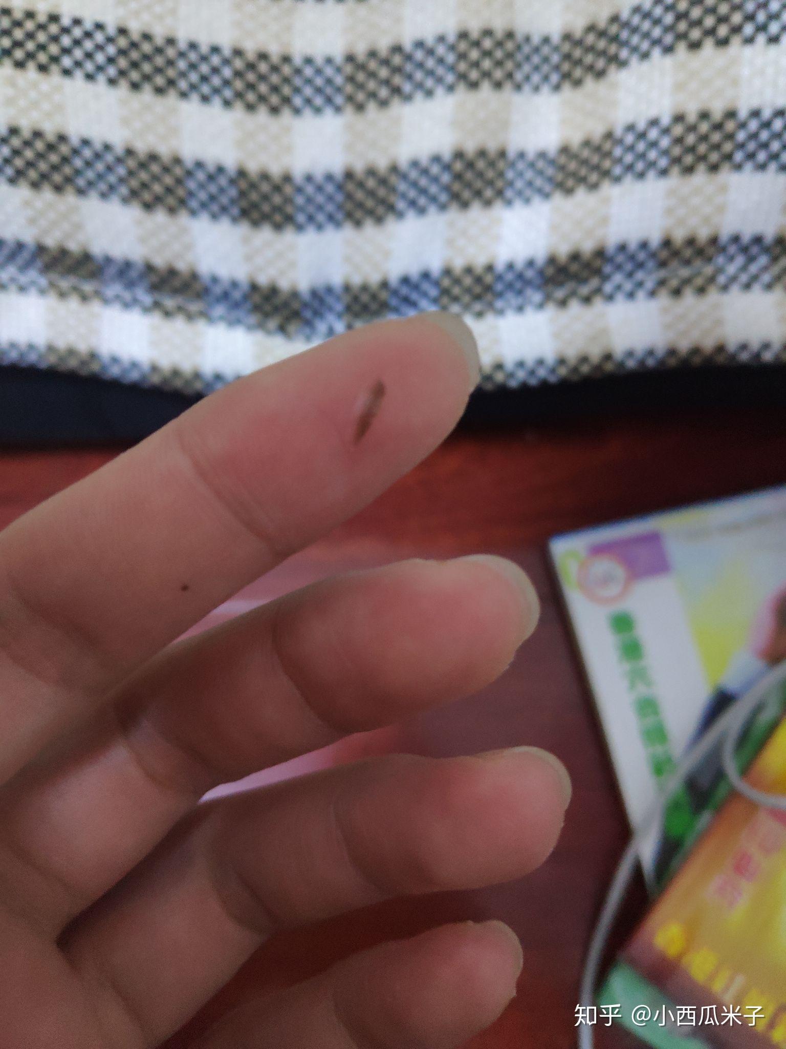 隐形眼镜碎在眼睛里怎么处理