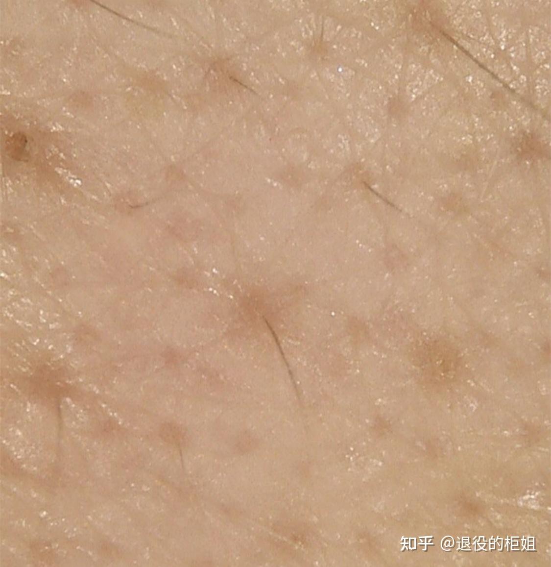 化妆皮肤却浮粉是为什么我应该怎么办